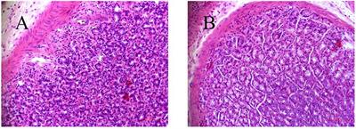 Deciphering the Mechanical Network of Chronic Atrophic Gastritis: A Urinary Time-Dependent Metabonomics-Based Network Pharmacology Study